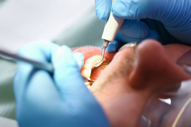Best Mobile Emergency Dentist in Broadlands, VA