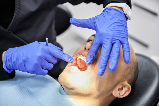 Best Emergency Dentist for Knocked-Out Tooth in Broadlands, VA
